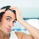 ahairlosscureHair Loss Help - It's Time To Stop Hair Loss