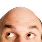 Ahairlosscurehair loss treatment do not fret little fella theres hope