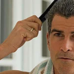 Ahairlosscuremale hair loss natural hair loss treatment